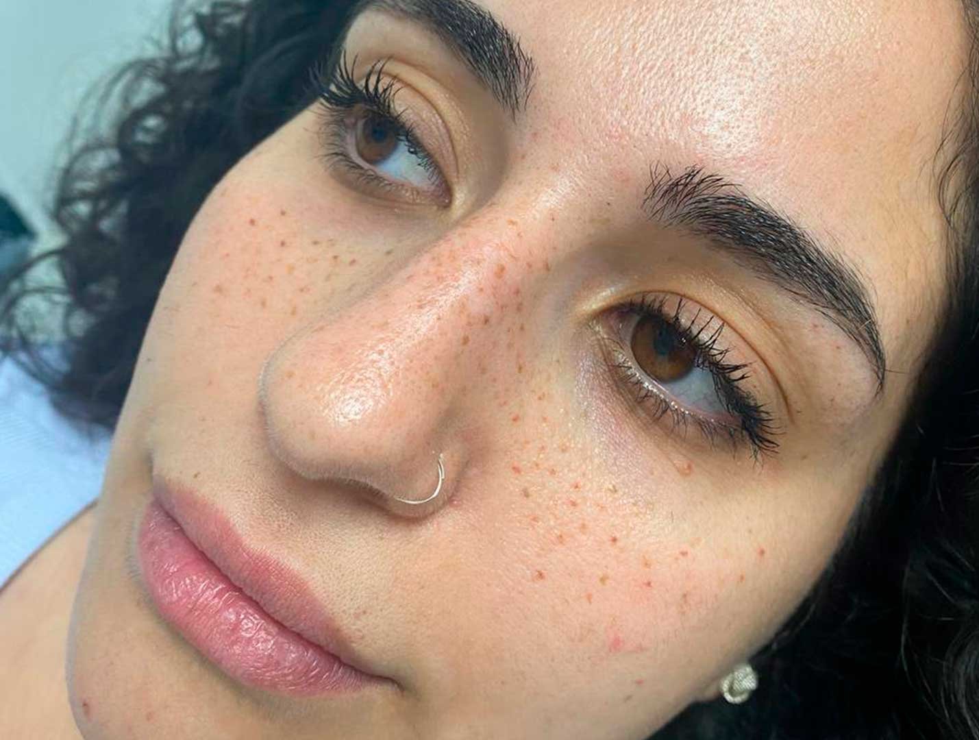 Freckles-Tattoo