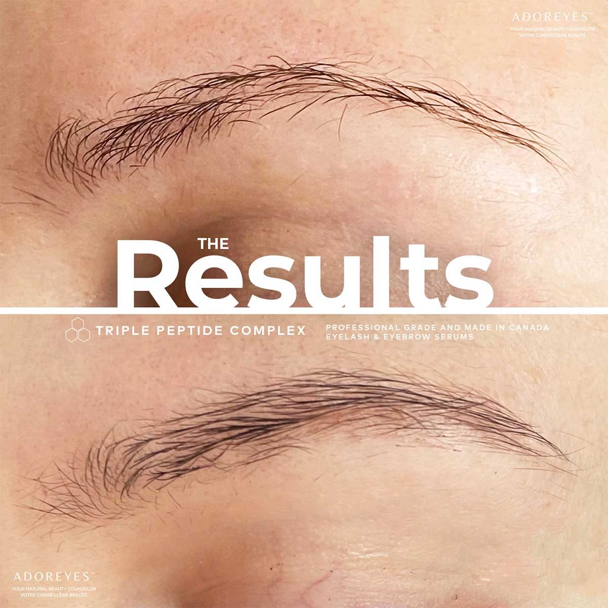 ADOREYES Plus Brows Eyebrow Enhancing Serum with Triple Peptide Complex (6 ml) - Image 3